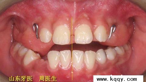 湖南省中职学校专业教师培训启动‘3377体育’(图3) 湖南省中职学校专业教师培训启动‘3377体育’(图3)